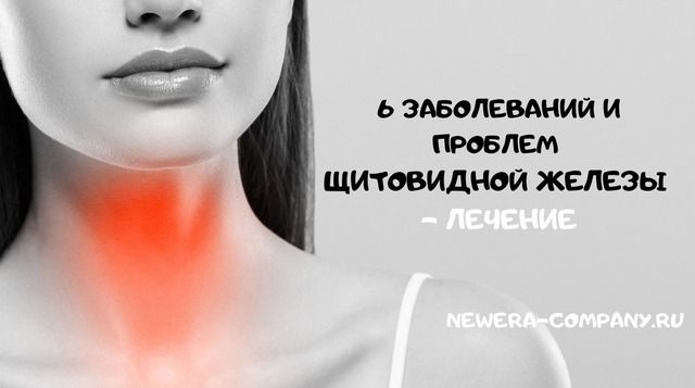 6 заболеваний и проблем Щитовидной железы - Лечение